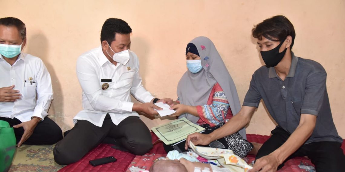 Pemkab Sidoarjo Fasilitasi Pengobatan Bayi Nayla Penderita Hidrosefalus dan Spina Bifida