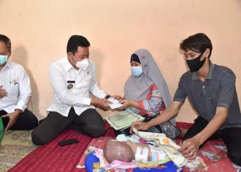 Pemkab Sidoarjo Fasilitasi Pengobatan Bayi Nayla Penderita Hidrosefalus dan Spina Bifida