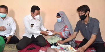 Pemkab Sidoarjo Fasilitasi Pengobatan Bayi Nayla Penderita Hidrosefalus dan Spina Bifida